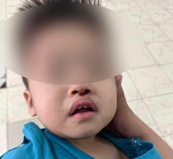 Bat khan cap nhom doi tuong hanh hung khien be 2 tuoi bi thuong