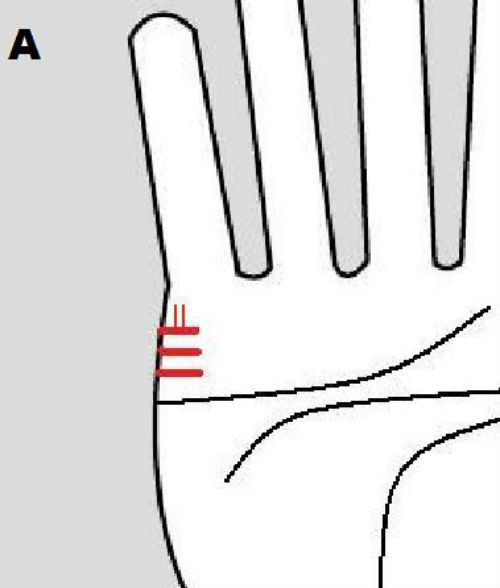 Nếu các đường chỉ này không rõ hoặc đan xen với các đường khác biểu hiện những đứa con của họ hay ốm vặt.