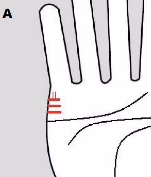 Nếu các đường chỉ này không rõ hoặc đan xen với các đường khác biểu hiện những đứa con của họ hay ốm vặt.