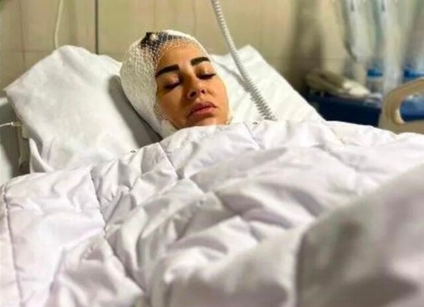 Co gai bi cho pitbull can phai khau 100 mui khap nguoi