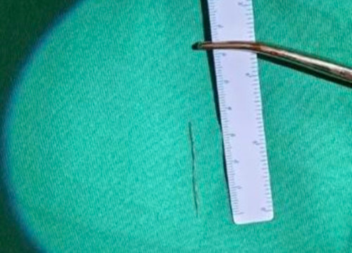 Tu cham cuu tai nha, nguoi dan ong thung tim