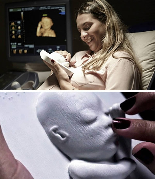 8. In hình ảnh siêu âm thành tranh 3D cho mẹ khiếm thị Video người mẹ khiếm thị "nhìn" thai nhi thông qua hình ảnh siêu âm được in nổi 3D mới đây đã thu hút hàng triệu lượt người xem trên Youtube trong vòng 2 ngày. Đó là chị Tatiana Guerra, 30 tuổi đến từ Tây Ban Nha và bị khiếm thị từ năm 17 tuổi. Trong video, hình ảnh siêu âm cho thấy thai nhi em bé của Guerra khá khỏe mạnh. 