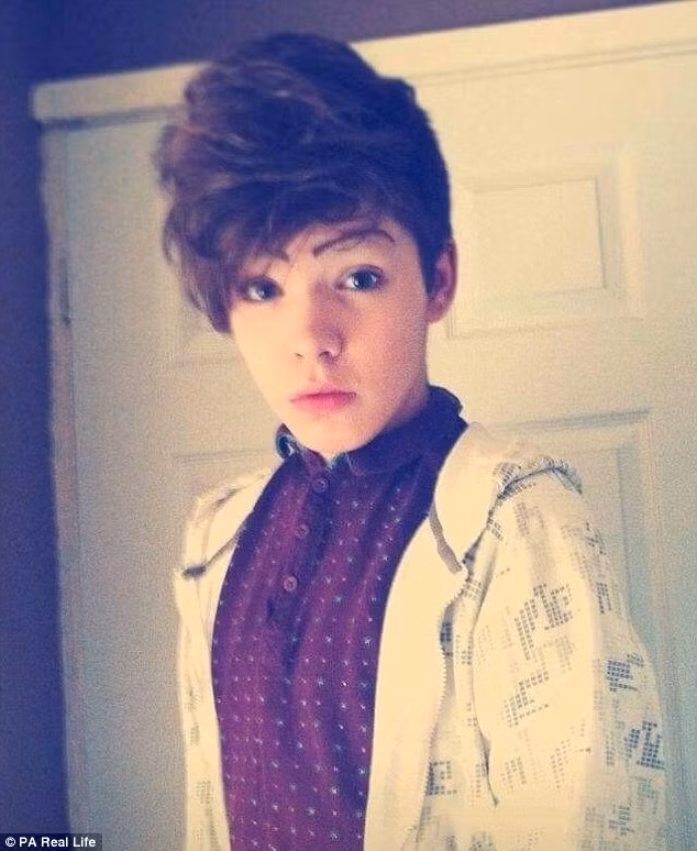 Callum cho biết, quá trình chuyển giới của cậu rất phức tạp bao gồm các việc như phẫu thuật chuyển đổi giới tính, phẫu thuật phụ nữ hóa trên khuôn mặt, giảm cằm, nâng mũi, cạo lông mày và nâng khuôn lông mày lên...