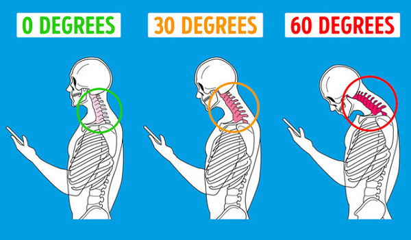 Để tránh có ngày "mọc sừng", hãy luôn ngồi thẳng lưng, tránh cúi gập người khi sử dụng điện thoại, và nhớ là sau 1h cần phải để cơ thể nghỉ ngơi.