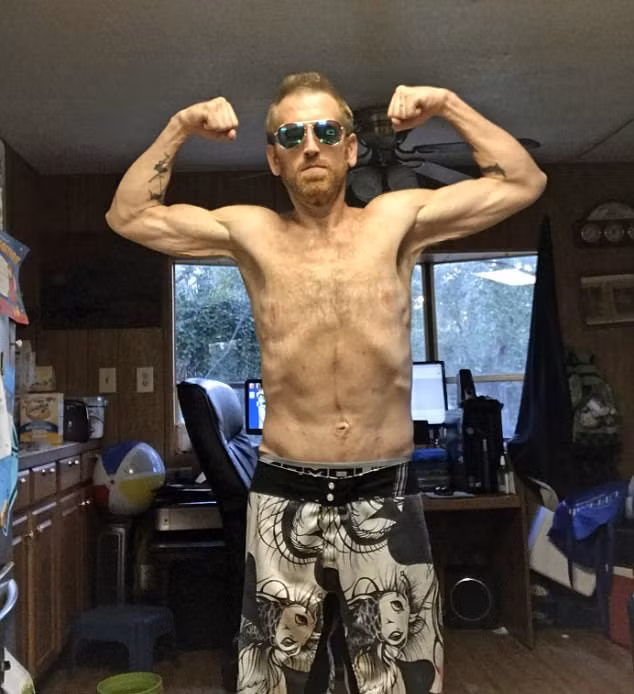 Để sống sót, để gia đình và bạn bè không phải đau buồn, đặc biệt là vì cậu con trai nhỏ, anh Zach đã bắt đầu hành trình giảm cân cực kỳ khó khăn. Đầu tiên, anh bỏ thuốc lá, bỏ uống các loại đồ uống có ga, không ăn đường, tiếp đó anh cố gắng đi bộ 10.000 bước mỗi ngày. (Nguồn Dailymail)