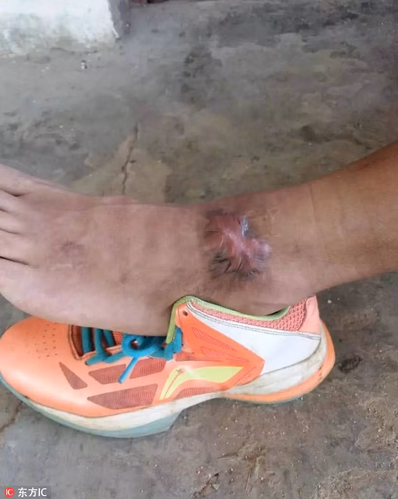 Được biết, "Nữ hoàng rắn" tên thật là Lý Chân Chân, bởi đam mê và tình yêu dành cho những con rắn độc quá lớn, Chân Chân đã rời bỏ công việc ở thành phố với mức lương cao nhiều người mơ ước. (Nguồn Sina)