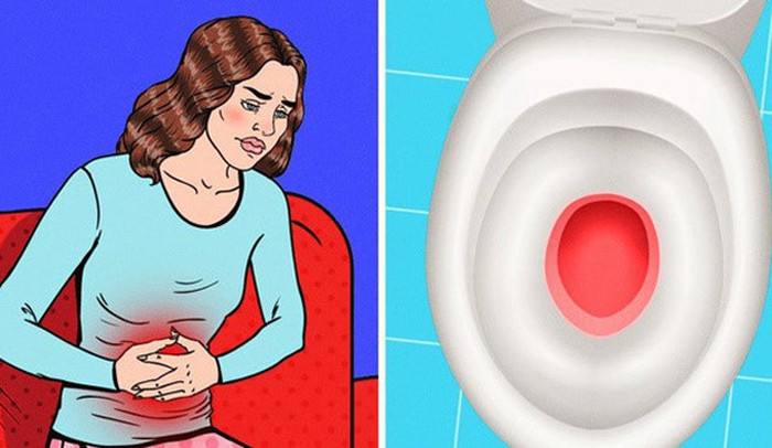 Đi tiểu không ra máu. Bạn có thể loại trừ hiện tượng này khi đang có kinh nguyệt. Nếu đã qua giai đoạn này mà vẫn có hiện tượng đi tiểu ra máu thì đó không phải hiện tượng bình thường chút nào. Nhiều khả năng, bạn đang có sỏi đường tiết niệu và mạch máu ở màng nhầy đường tiết niệu chính là nguyên nhân khiến nước tiểu có màu đỏ.