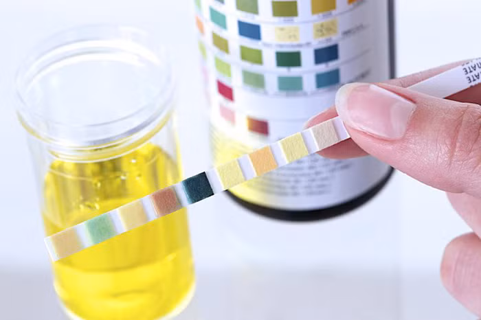 Trong trường hợp bình thường, nước tiểu nên có màu vàng nhạt và trong. Khi nước tiểu có màu đỏ, có thể bạn đang gặp vấn đề bất thường trong đường tiết niệu hoặc đường sinh sản.