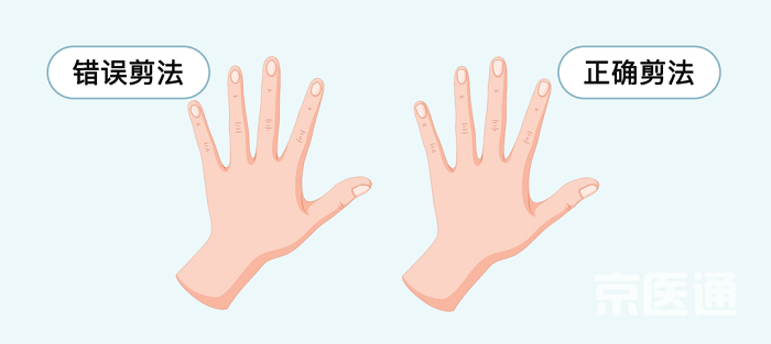 Cắt móng tay. Cắt móng tay quá tròn hoặc quá ngắn khiến móng tay mọc mới có xu hướng mọc “ăn” sâu vào vùng da tay. Chưa kể việc cắt móng quá ngắn còn có thể cắt vào da gây đau đớn, bất tiện trong sinh hoạt. Để khắc phục, khi cắt nên chừa một mép nhỏ dài hơn đầu ngón tay 1mm. Móng tay có thể cắt theo hình bầu dục trong khi móng chân được khuyến khích cắt theo hình vuông.