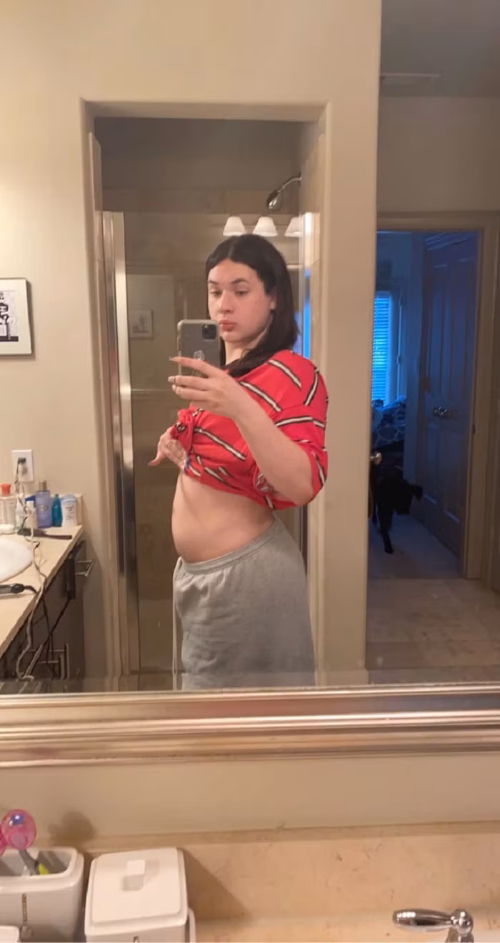 Hiện, Mikey mang thai ở tháng thứ 4. Mikey được bổ sung estrogen trong suốt quá trình mang thai, do đó cô cảm thấy mình là phụ nữ đích thực hơn bao giờ hết. Mikey cũng có kế hoạch trở về giới tính thực của mình sau khi lâm bồn. Trở thành người mẹ tốt, đồng hành cùng con từ khi chập chững cho đến lúc trưởng thành.