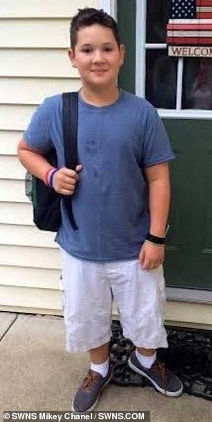 Mikey được cha mẹ nuôi dưỡng như một bé trai bình thường. Tuy nhiên, từ nhỏ cậu đã thấy cơ thể có nhiều khác biệt so với đám bạn trai cùng lứa. Ở tuổi lên 5, Mikey thích tô son của mẹ và thường tạo dáng với túi xách nữ tính của dì.