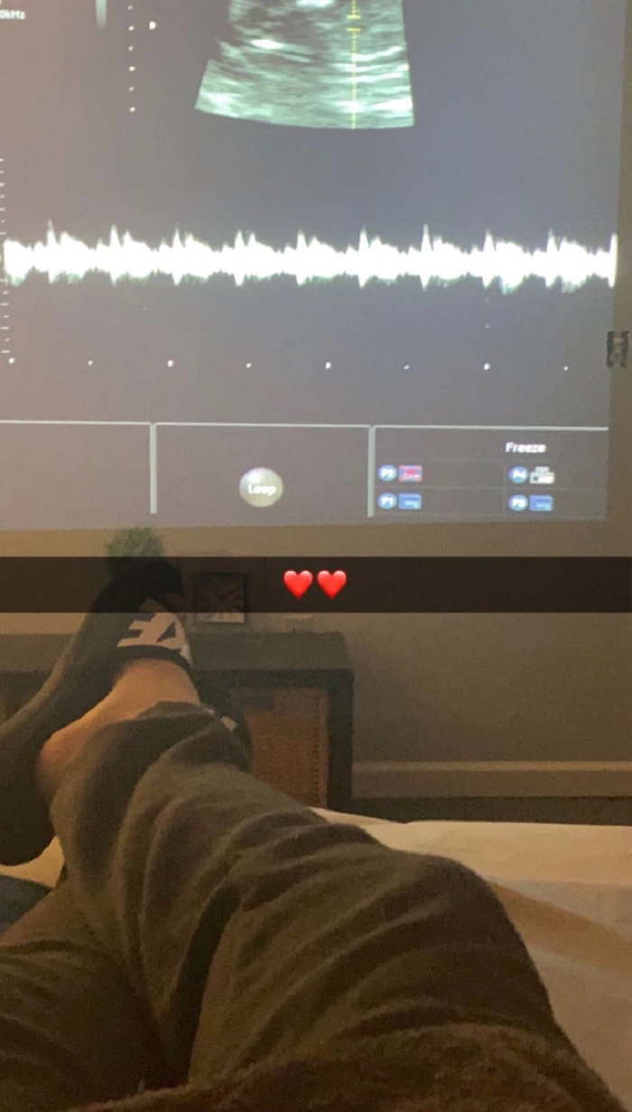 Tuy nhiên, năm ngoái – khi 17 tuổi, Mikey cảm thấy khó chịu mỗi lần đi tiểu hoặc quan hệ tình dục. Lo lắng mắc bệnh hiểm, anh tới gặp bác sĩ và được chỉ định siêu âm niệu đạo. Vị bác sĩ lặng người khi phát hiện bên trong cơ thể Mikey là một người phụ nữ với đầy đủ cổ tử cung, tử cung, ống dẫn trứng và buồng trứng.