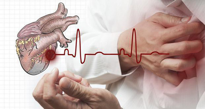 Mệt mỏi không rõ nguyên nhân. Bạn cần hết sức cảnh giác nếu đối diện tình trạng mệt mỏi, tức ngực và phù nề không rõ nguyên nhân. Nên đi khám bác sĩ càng sớm càng tốt bởi dấu hiệu này có thể bắt nguồn từ bệnh viêm cơ tim nguy hiểm. Đáng lưu ý, viêm cơ tim dễ gặp ở người trẻ tuổi. Bệnh thường xuất hiện sau khi cảm lạnh từ 1 – 2 tuần.