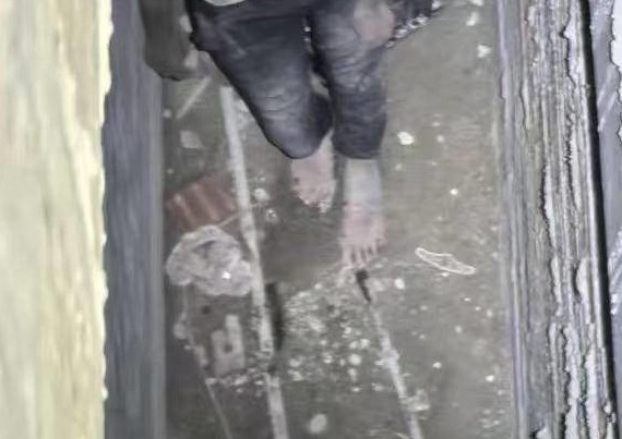 Tuy đã qua giai đoạn nguy hiểm đến tính mạng nhưng tình trạng tâm thần của Dư Tiểu Mai không ổn định, thường xuyên xuất hiện ảo giác. Kết quả xét nghiệm trí tuệ cho thấy Dư Tiểu Mai bị khuyết tật trí tuệ mức độ trung bình.