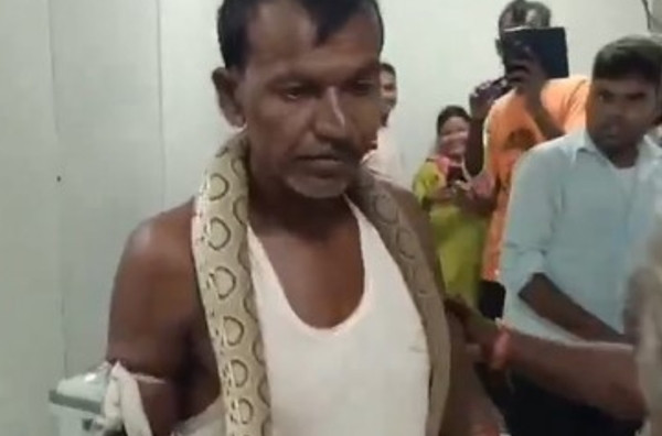 Theo truyền thông Ấn Độ, ông Prakash Mandal (48 tuổi), cư dân làng Mirachak, thành phố Bhagalpur đã xuất hiện tại bệnh viện với một con rắn cực độc trên cổ, khiến mọi người khiếp sợ.