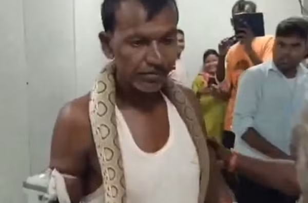 Theo truyền thông Ấn Độ, ông Prakash Mandal (48 tuổi), cư dân làng Mirachak, thành phố Bhagalpur đã xuất hiện tại bệnh viện với một con rắn cực độc trên cổ, khiến mọi người khiếp sợ.