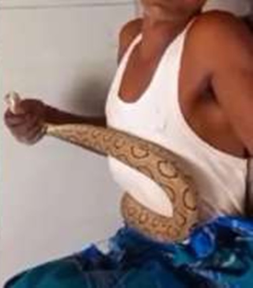 Nọc độc của hổ lục Russell tấn công hệ thần kinh và hệ tim mạch của nạn nhân, gây ra các triệu chứng nghiêm trọng như đau dữ dội, sưng tấy, chảy máu và trong nhiều trường hợp có thể dẫn đến suy thận, suy tim, tử vong.