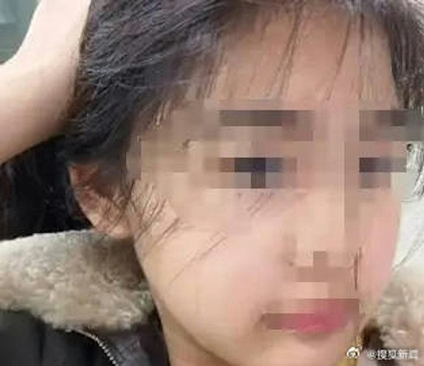 Tuy nhiên, chỉ hai tháng sau, cha mẹ Tiểu Lâm nhận được tin báo từ trường học và khi gặp lại con gái, họ bàng hoàng khi thấy con mình đang nằm trong phòng chăm sóc đặc biệt của bệnh viện. Lúc này, Tiểu Lâm đã gầy đi 20kg, không thể đi lại, mắt gần như mù, toàn thân đầy thương tích của việc bạo hành. Sau khoảng một tháng điều trị, Tiểu Lâm đã tử vong vì vết thương quá nặng.