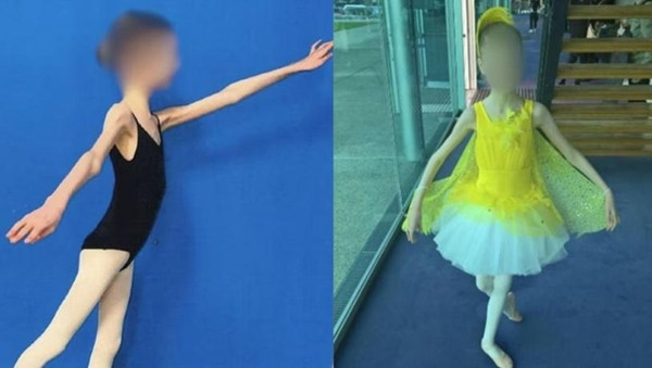 Những ngày gần đây, câu chuyện về A.H, một cô gái 17 tuổi ở thành phố Perth, phía Tây Australia, đang gây chấn động dư luận nước này. A.H bị cha mẹ kiểm soát nghiêm ngặt chế độ ăn uống, ép cô ăn chay, dẫn đến tình trạng suy dinh dưỡng nghiêm trọng, chỉ nặng vỏn vẹn gần 28kg. (Ảnh: Chinatimes, Stheadline, Healthdaily)