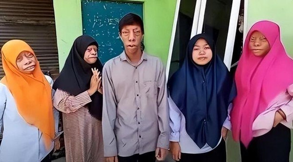 Em gái út có khuôn mặt bình thường đã quay video về gia đình và đăng tải lên mạng. Bất ngờ, video trở nên nổi tiếng và họ nhanh chóng thu hút sự chú ý của nhiều người. Dần dần, những lời chỉ trích được thay thế bằng sự ủng hộ và khích lệ.