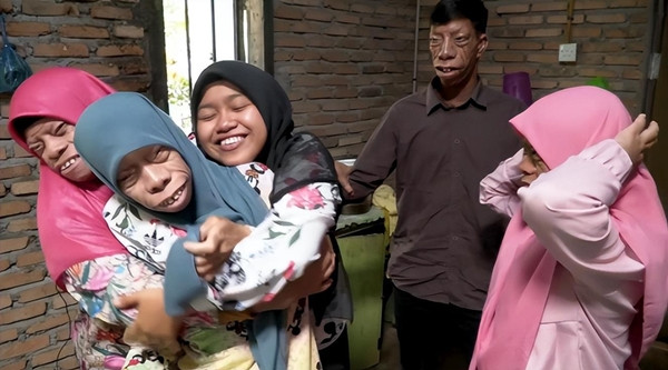 Không chỉ riêng Surya mà ngay cả các chị em gái của anh cũng mang ngoại hình tương tự. Gia đình họ luôn bị nghi ngờ và lời đồn rằng gia đình họ bị "ma quỷ ám, nguyền rủa" cũng bắt đầu lan rộng. Họ gặp nhiều khó khăn trong cuộc sống và công việc.