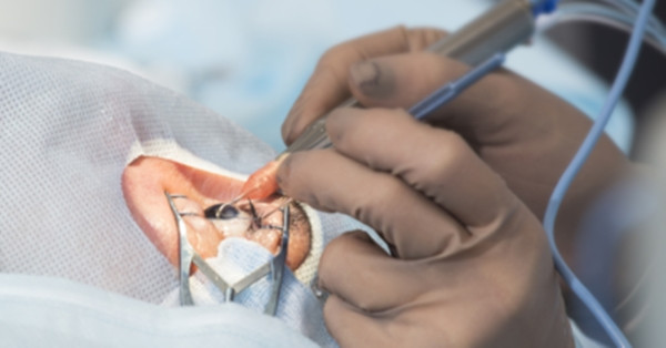 "Trước khi phẫu thuật, bệnh viện chỉ tập trung kiểm tra mắt phải. Trong quá trình phẫu thuật, bác sĩ cũng không hề thông báo với chúng tôi về việc mắt trái của con gái tôi cũng cần phẫu thuật. Chúng tôi hoàn toàn không biết chuyện gì đã xảy ra. Đội ngũ y tế làm việc quá tùy ý rồi", anh Trương chia sẻ.