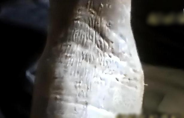 Trong khi làng đang xôn xao về "lời nguyền", một bác sĩ Trung y họ Phó từ thành phố xa nghe tin và quyết định đến thăm khám cho ông Hàn. Qua kiểm tra, bác sĩ phát hiện ông Hàn không chỉ bị mắc bệnh phong thấp do lao động quá sức, mà còn bị nhiễm trùng do ăn sống gan rắn, chứa nhiều vi khuẩn và tác nhân gây bệnh. Điều này đã gây ra căn bệnh da liễu nghiêm trọng mà ông đang mắc phải.