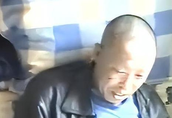 Bác sĩ bắt đầu điều trị cho ông Hàn bằng các phương pháp Đông y kết hợp với thuốc và sau một thời gian, tình trạng của ông Hàn dần cải thiện. Vảy trên da bắt đầu giảm đi, ông cũng không còn cảm thấy ngứa ngáy khó chịu nữa.