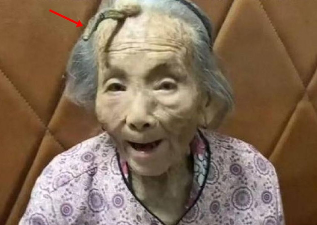 Khi được hỏi tại sao lại mọc ra chiếc sừng trông đáng sợ như vậy, cháu chắt của bà Trần cho biết, họ không rõ nguyên nhân. Chỉ biết khi bước qua tuổi 100, bà Trần bắt đầu có những dấu hiệu mọc sừng trên đầu.