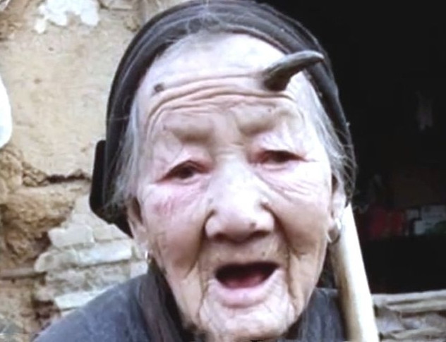 Câu chuyện của bà Trần, bà Lý cũng như bà Trương là lời nhắc nhở về tầm quan trọng của việc theo dõi sức khỏe và thăm khám bác sĩ định kỳ, đặc biệt là khi xuất hiện những thay đổi bất thường trên cơ thể.