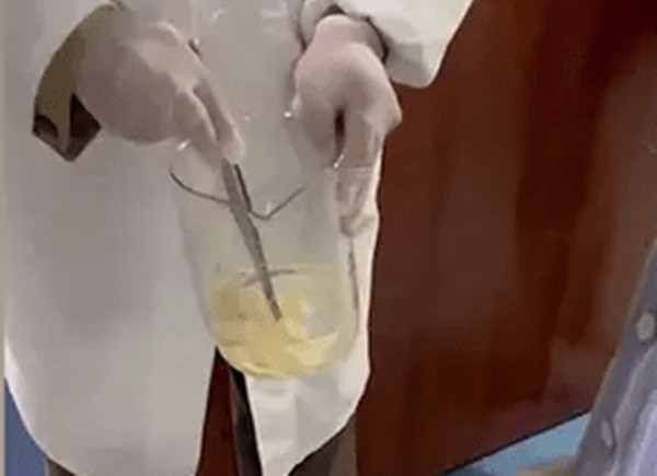 Trứng sán dây bò không móc có thể tồn tại trong thịt sống chưa được chế biến kỹ và khi được ăn vào, chúng sẽ phát triển thành sán trưởng thành trong ruột người.