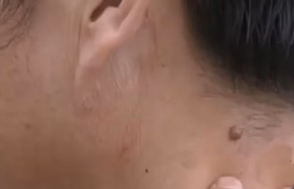 Thậm chí, nốt ruồi sau gáy của họ cũng giống hệt nhau, điểm khác biệt duy nhất là Chu Cần Dư đeo kính. Hai người giống nhau đến nỗi cứ như đang soi gương. Ban đầu, họ nghĩ chỉ là tình cờ giống nhau, thế giới rộng lớn, không thiếu điều kỳ lạ, giống nhau cũng không có gì ngạc nhiên, có lẽ chỉ là duyên phận.