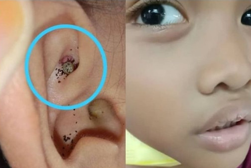 Be trai dau tai, kiem tra phat hien “quai vat” ghe ron ky sinh