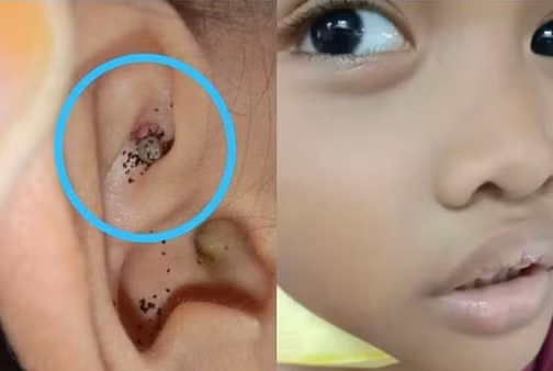 Be trai dau tai, kiem tra phat hien “quai vat” ghe ron ky sinh