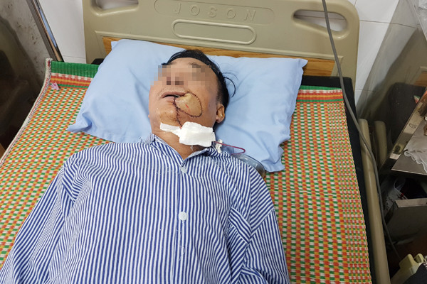 Chúng ta thường gặp phải những rắc rối nhỏ về thể chất trong cuộc sống, chẳng hạn như sốt, cảm, đau răng và chóng mặt. Đa số sẽ lựa chọn uống một số loại thuốc hoặc không để tâm quá nhiều. Nhưng chúng ta cũng thường nghe một số người thân quen xung quanh mình, có người bị bệnh tiểu đường, một số người mắc ung thư gan, v.v. và tất cả những người dễ bị ung thư đều có điểm chung! (Ảnh minh họa)