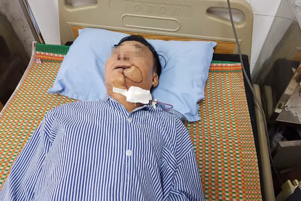 Chúng ta thường gặp phải những rắc rối nhỏ về thể chất trong cuộc sống, chẳng hạn như sốt, cảm, đau răng và chóng mặt. Đa số sẽ lựa chọn uống một số loại thuốc hoặc không để tâm quá nhiều. Nhưng chúng ta cũng thường nghe một số người thân quen xung quanh mình, có người bị bệnh tiểu đường, một số người mắc ung thư gan, v.v. và tất cả những người dễ bị ung thư đều có điểm chung! (Ảnh minh họa)