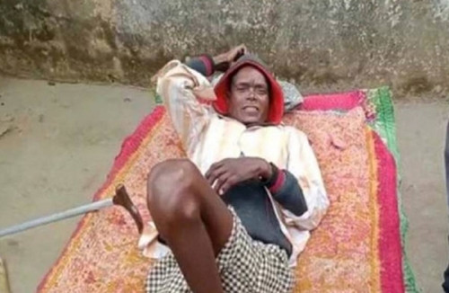 Tiem vac xin COVID-19, nguoi dan ong dang liet bong di lai binh thuong