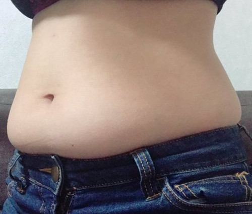 Wei Shen, giáo sư tại Trung tâm Nghiên cứu Dinh dưỡng New York của Đại học Columbia, tin rằng phép đo lượng mỡ nội tạng chính xác nhất là sử dụng MRI. Nếu MRI được sử dụng để xác định giá trị của mỡ nội tạng thì giá trị của nghiên cứu này sẽ đáng tin cậy hơn.