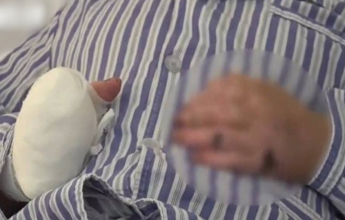 Bi ep uong 2 chen ruou, nguoi dan ong cut tay vi dieu nay