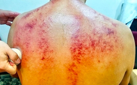 Met moi lien cao gio, nguoi dan ong suyt tu giet minh