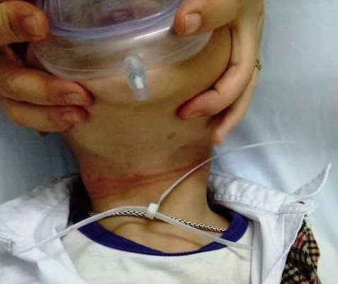 Ngoan muc cuu song be trai bi day nhua thit co