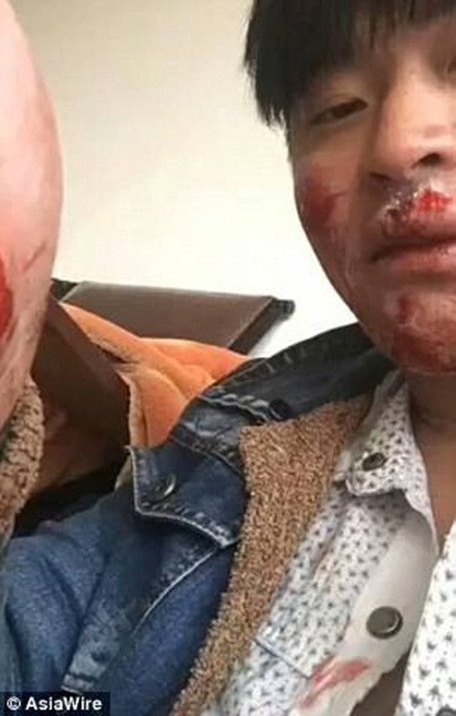 Nam thanh niên nhận kết đắng khi trêu nhầm đối tượng. Ảnh cắt từ clip.