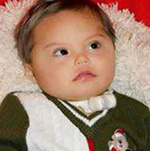 Kinh hoang em be benh Down bi me giet bang nuoc rua tay