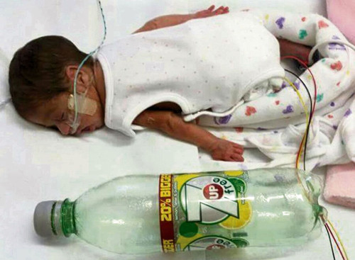 Vợ chồng tôi có 4 người con, Finnley (7 tuổi), Oscar (5 tuổi), Isla (4 tuổi) và Alice (2 tuổi). Tôi tìm đến biện pháp tránh thai được tư vấn hiệu quả 99% nên hoàn toàn bất ngờ khi biết tin mình đã mang thai 7 tuần.