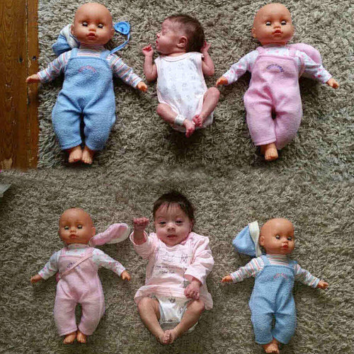 Nói về con gái, chị Laurie (28 tuổi) chia sẻ: “Matilda đến với gia đình như một phép màu. Tôi từng dùng biện pháp tránh thai song Matilda vẫn hiện diện. Dù khả năng sống sót là rất thấp song con gái tôi vẫn kiên cường vượt qua để ở bên các thành viên trong gia đình. Sức sống kỳ diệu này thực sự là điều khó tin".