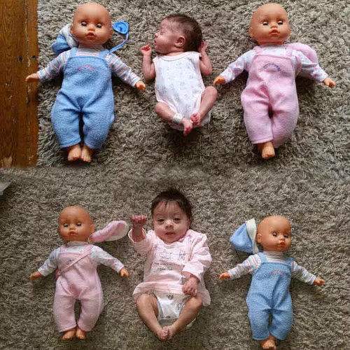 Nói về con gái, chị Laurie (28 tuổi) chia sẻ: “Matilda đến với gia đình như một phép màu. Tôi từng dùng biện pháp tránh thai song Matilda vẫn hiện diện. Dù khả năng sống sót là rất thấp song con gái tôi vẫn kiên cường vượt qua để ở bên các thành viên trong gia đình. Sức sống kỳ diệu này thực sự là điều khó tin".