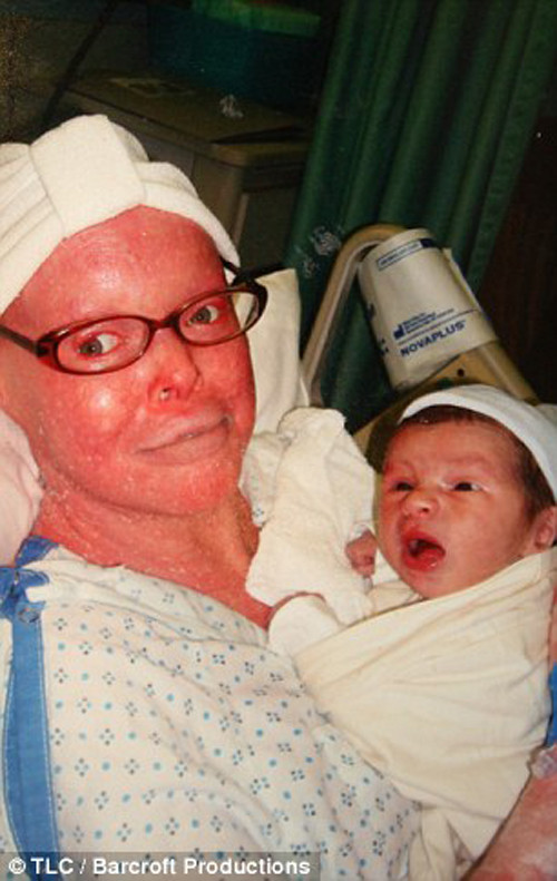 Các bác sĩ cũng cảnh báo Stephanie có thai không khác gì đánh cược mạng sống của mình. Mang thai khiến da của bệnh nhân bị kéo căng, nứt toác. Chưa có trường hợp mắc chứng Harlequin nào sinh con từng được ghi nhận trước đó.