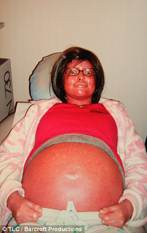 Stephanie không hề tự ti về ngoại hình của mình. Ngoài sự khác biệt về làn da, cô thấy mình cũng giống như bao nhiêu người khác.