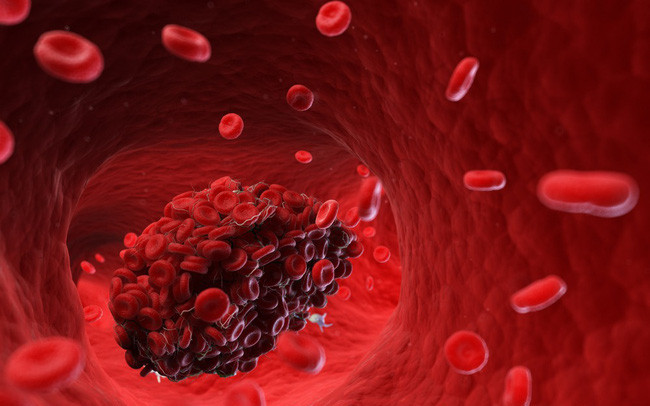 1. Ngáp liên tục: 80% bệnh nhân thiếu máu não cục bộ sẽ ngáp lặp đi lặp lại 5-10 ngày trước khi khởi phát bệnh. Khi nhận thấy hiện tượng bất thường này và không chắc mình có bị thuyên tắc mạch máu não hay không, bạn nên đến bệnh viện để khám kịp thời.