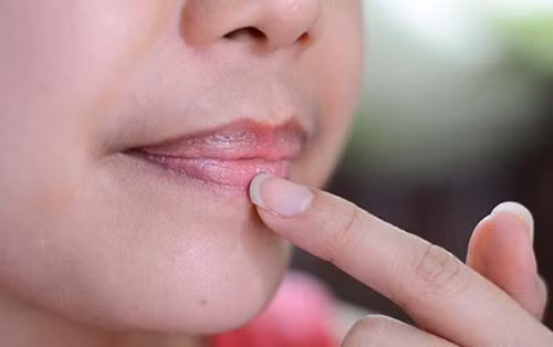 Môi có màu đen là biểu hiện của tình trạng thiếu dương, cơ thể bị lạnh, hư hàn xâm nhập. Nếu có thêm các triệu chứng như lạnh tay chân thì bệnh lại càng nghiêm trọng hơn. Lương y nhấn mạnh, nếu môi có màu tím đen đồng thời vành tai trở nên tím xanh thì nên đi khám càng sớm càng tốt.